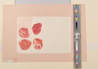 Go to image 2.